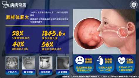 昇思项目分享 腺形智消——新一代儿童腺样体肥大诊疗方案领航者基于昇思mindspore的智慧医疗创新解决方案 Csdn博客