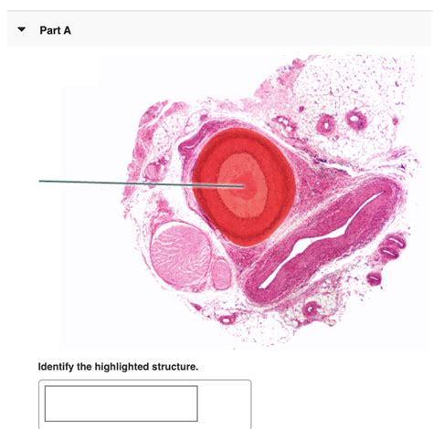 Solved Part A Identify The Highlighted Structure Chegg