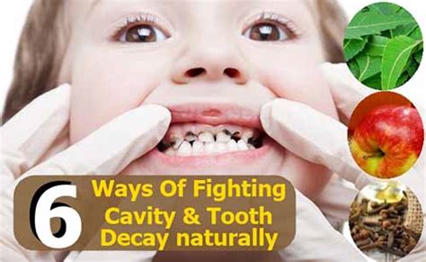 6 Natural Remedies For Cavities