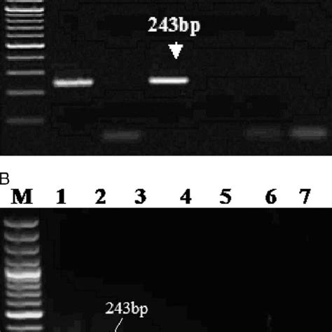 Sybr Green Diagnostic Quantitative Polymerase Chain Reaction Qpcr For