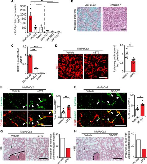 IL 33 Induced MMP9 In Macrophages Promotes Metastasis In Human PDAC