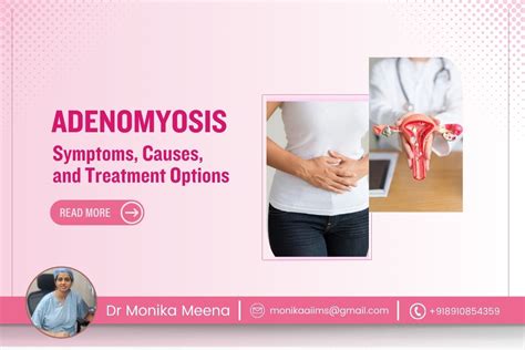 Understanding Adenomyosis Symptoms Causes And Treatment Options Dr