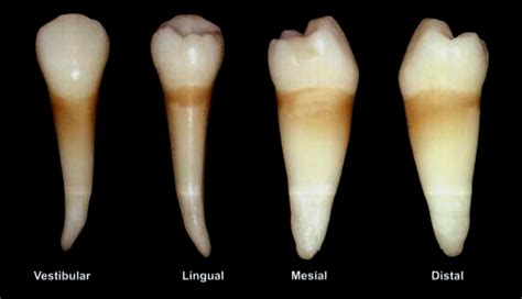 Pré Molares Descrição Anatômica Odontoup