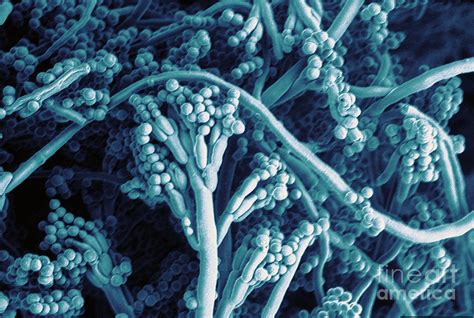 Penicillium Nalgiovense Fungus Sem Photograph By Scimat Pixels