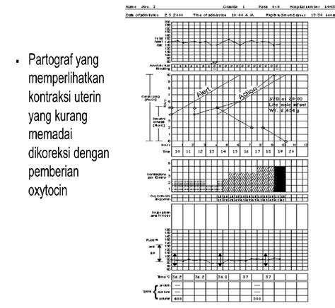 Contoh Kasus Persalinan Normal Beserta Partograf Karya Tulis Ilmiah