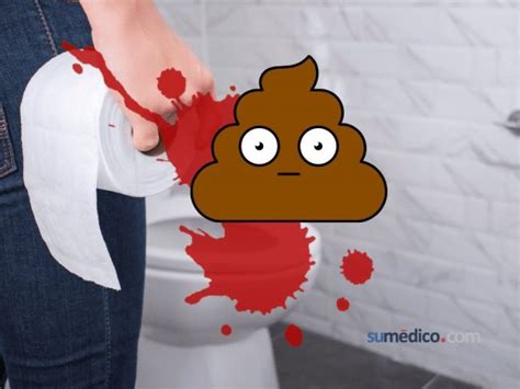 Cómo es la popo con sangre MiBBmemima