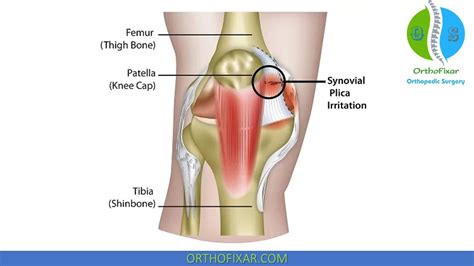 Knee Anatomy Plica