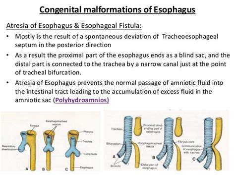 Development Of The Foregut Esophagus And Stomach