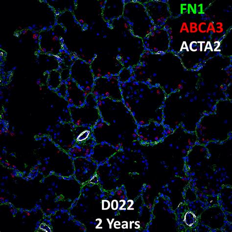 Year Old Human Lung Immunofluorescence And Confocal Imaging Donor