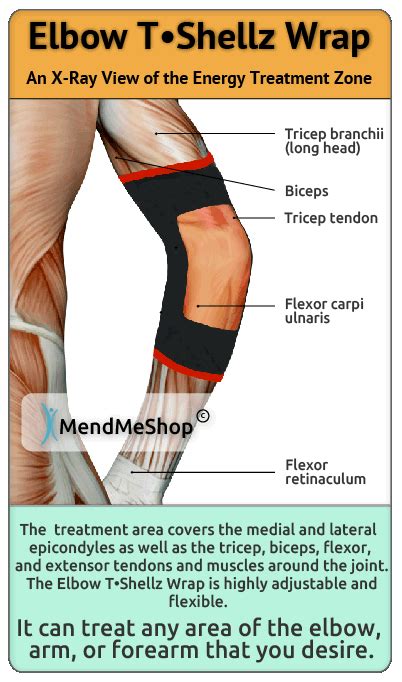 Ice (Cold) vs Heat - What's Better to Treat Tennis Elbow or Golfer's Elbow?