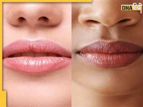 होठों का रंग पड़ गया है काला तो इन तरीकों से पाएं Natural Pink Lips