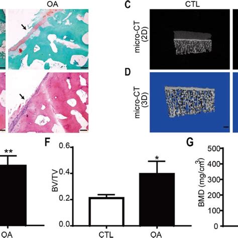 Histological And Microstructural Changes In The Subchondral Bone Of The