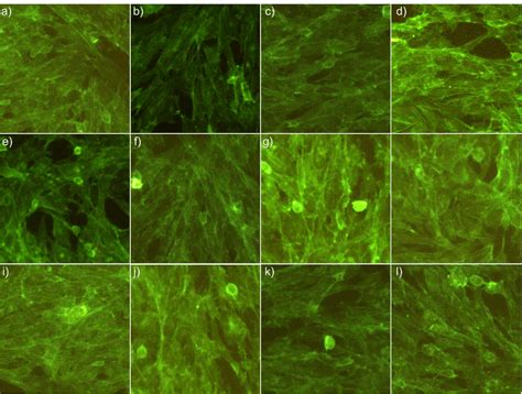 The Morphology Of The Control HFOB 1 19 Cells A And Of HFOB 1 19