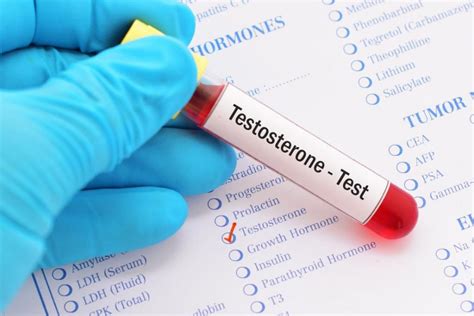 Testosterone Blood Test At Home Cja Balance Uk Doctors