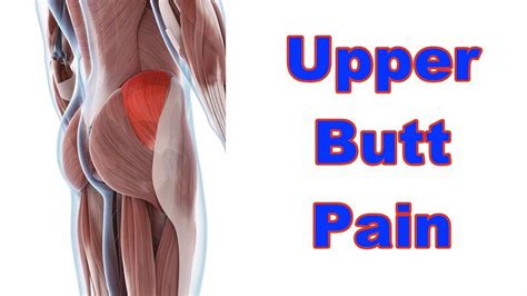 Pain In Left Buttock Cheek Stretch At Rose Ladner Blog