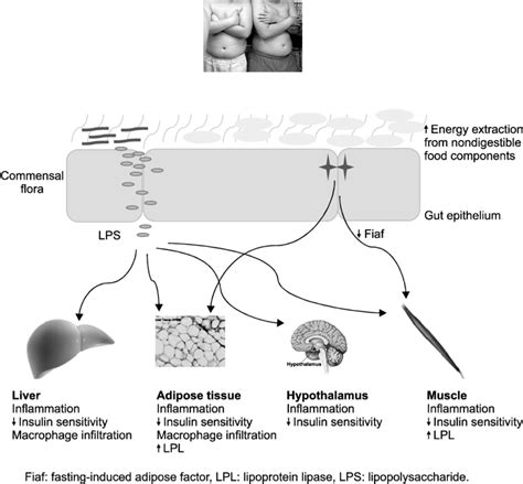 Schematic View Of The Possible Mechanisms Linking Gut Microbiota To