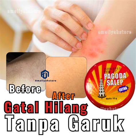 Jual Pagoda Salep Krim Obat Gatal Panu 100 Cream Penghilang Gatel