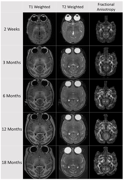 Frontiers UNC Emory Infant Atlases For Macaque Brain Image Analysis