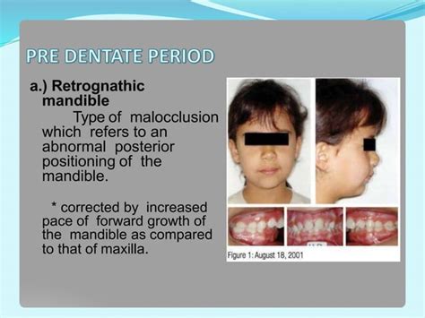 Self Correcting Anomalies Vibhor Ortho PPT