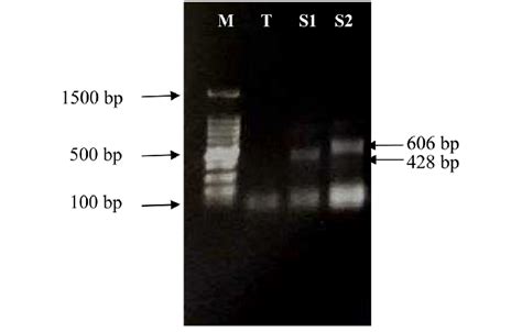 Agarose Gel Electrophoresis 07 Of Pcr Products From Multiplex Pcr