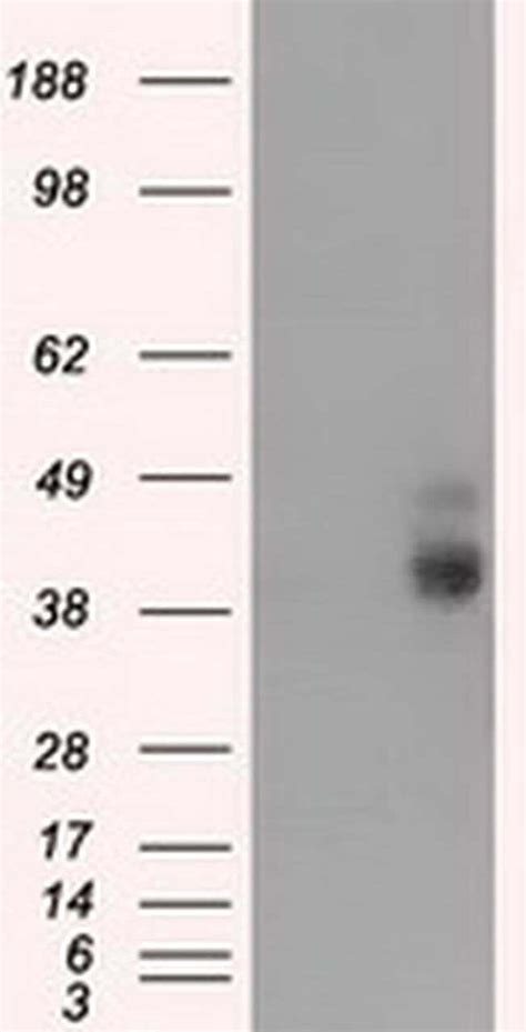 Bsg Monoclonal Antibody Oti E Truemab Origene L Unconjugated