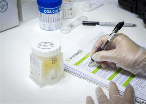 How to Make Sure You Pass an Employee Drug Screening