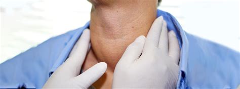 Goiter | Johns Hopkins Medicine