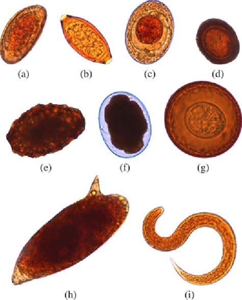 Identifying Human Intestinal Parasites Pictures