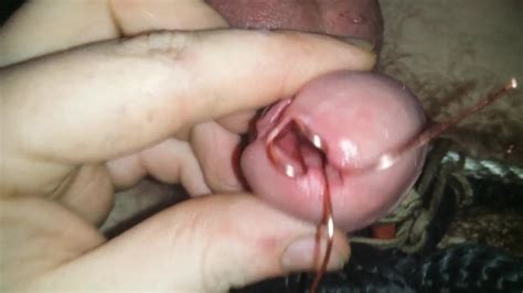 Urethral Speculum Free Gay Hd Porn Video F Xhamster