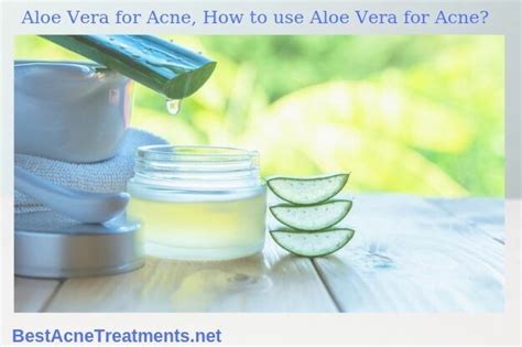 Aloe Vera for Acne, How to use Aloe Vera for Acne? - Top Acne ...