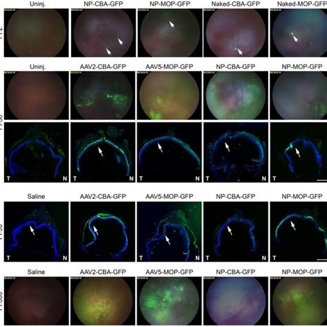 P Balb C Mice Were Subretinally Injected With Naked CBA GFP