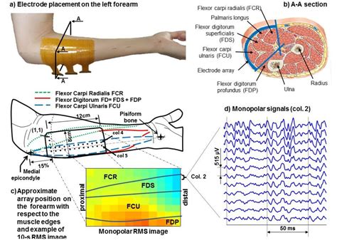 Figure 1 From Analysis Of High Density Surface EMG And Finger Pressure