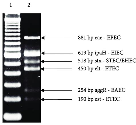 2 Agarose Gel Electrophoresis Visualization Of Amplified Genes Used Download Scientific