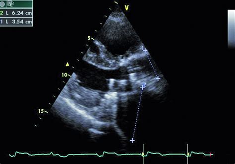 Kardiologia Po Dyplomie Echoszarada