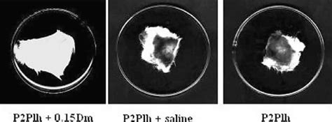 Neutralization Of P2Plh Venom Induced Hemorrhagic Activity By 0 15Dm