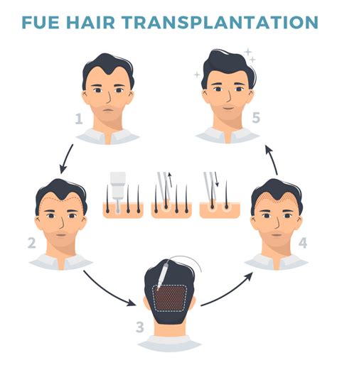 Visit Our Fue Hair Transplant Centre For Affordable Prices Ozhean