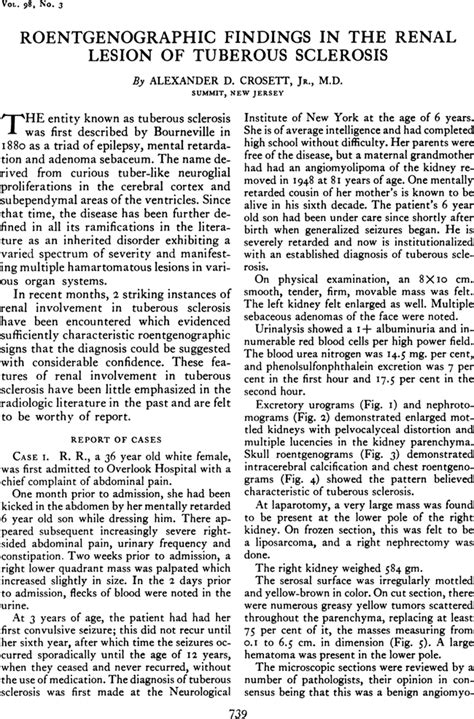 Roentgenographic Findings In The Renal Lesion Of Tuberous Sclerosis Ajr