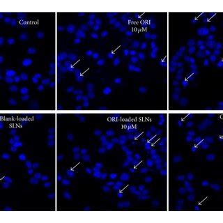 Apoptotic morphology of MCF 7 cells treated with 20 μM and 10 μM free