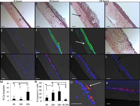 Tissue Sections Showing Kinetics Of C Albicans Mucosal Biofilm Download Scientific Diagram