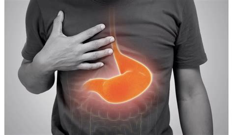 Le Reflux Gastro œsophagien Rgo Comprendre Prévenir Et Traiter