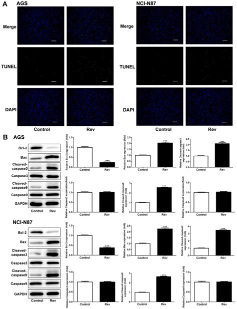 Reversine Inhibits Proliferation Invasion And Migration And Induces