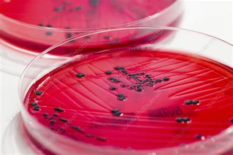 Salmonella Enterica Culture On Xld Agar Stock Image C0291360 Science Photo Library