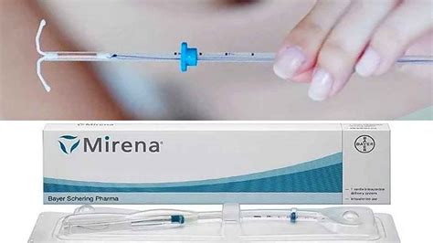 Мирена п