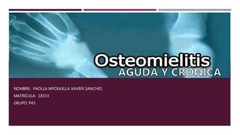 Osteomielitis Aguda Y Cronica