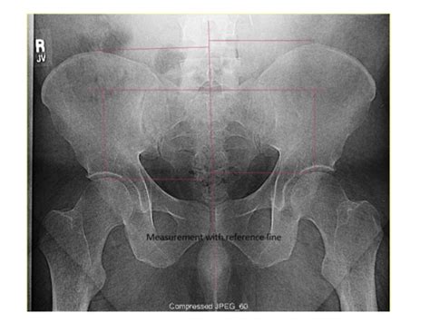 Postural Exam Xray Flashcards Quizlet