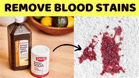 How To Remove Dried Blood Stains From Carpet With Baking Soda And