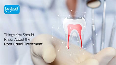 Things You Should Know About The Root Canal Treatment Face Kraft Clinic