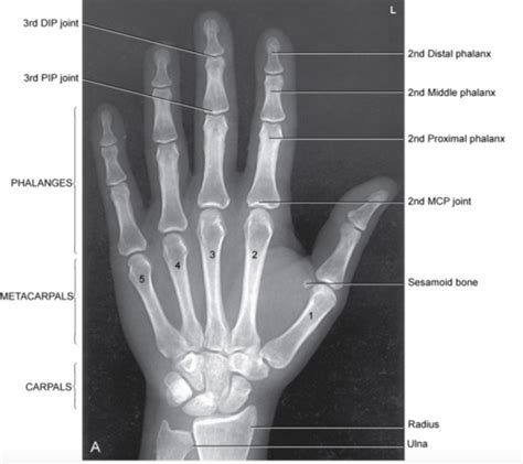 Radiography Flashcards Complete Flashcards Quizlet