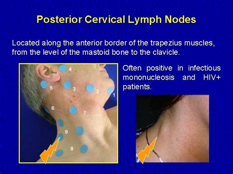 Inguinal Lymphatic System Nodes