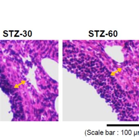 PCOS Phenotype Of STZ Treated Mice Ovarian Follicles A Diameter Of